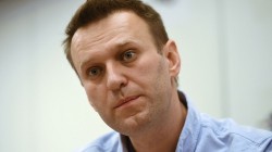 Врачи уменьшили глубину комы Навального за время его пребывания в Омске Врачи уменьшили глубину комы Навального за время его пребывания в Омске
