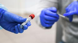 В Палестине выявили 465 новых случаев заражения коронавирусом